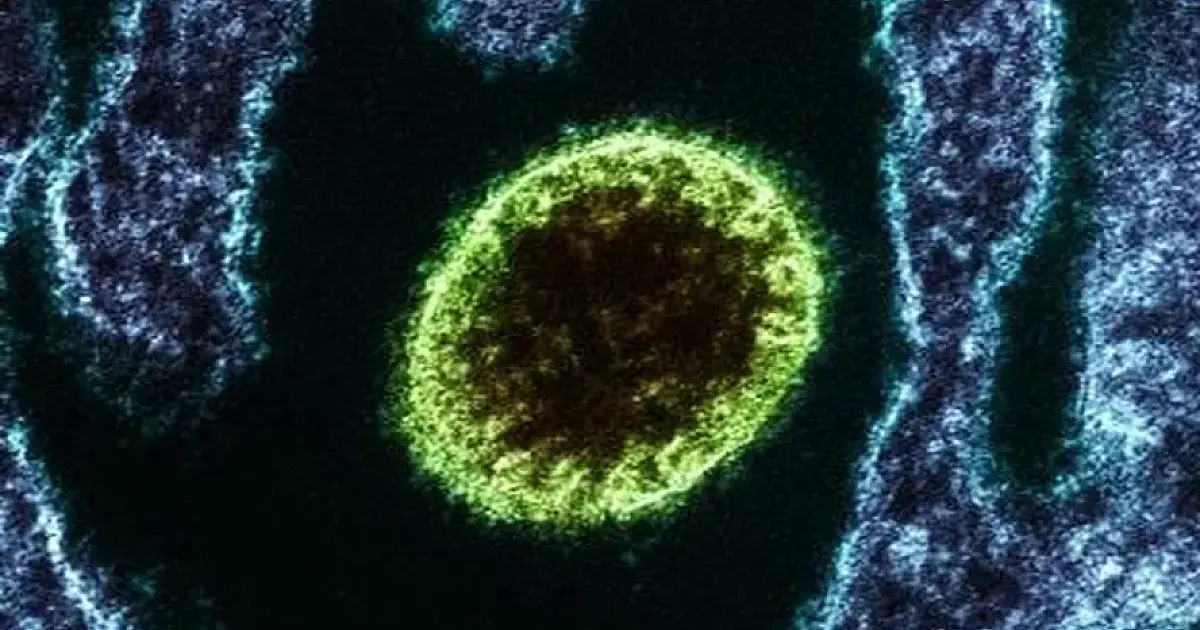 Alerta global: surto de Nipah na Índia preocupa saúde pública mundial