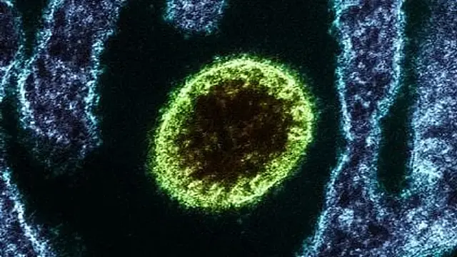 Alerta global: surto de Nipah na Índia preocupa saúde pública mundial
