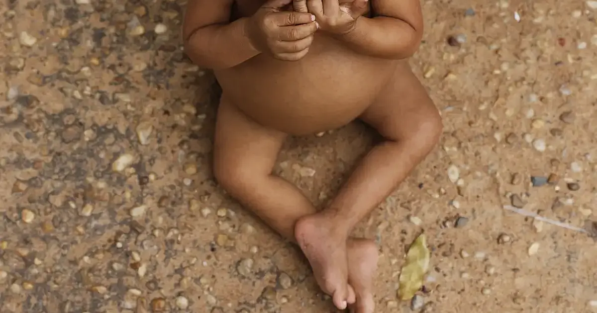 Vulnerabilidade social reduz altura média de crianças indígenas e nordestinas até 9 anos de idade