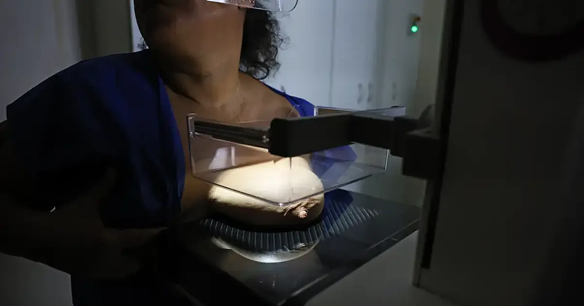 92% das brasileiras entre 50 e 69 anos já fizeram mamografia, revela Vigitel: avanço histórico no combate ao câncer de mama impulsiona detecção precoce