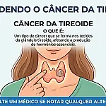 SUS Paulista eleva repasses em até 300% contra câncer de tireoide