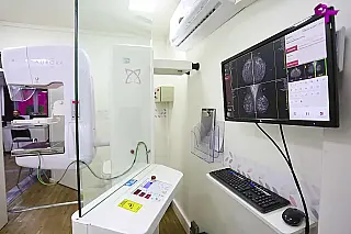 Carretas da Mamografia rodam SP para agilizar exames contra o câncer de mama